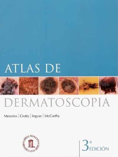 Atlas de Dermatoscopia 3 Edición