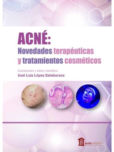 Acné Novedades Terapéuticas Y Tratamientos Cosméticos 1 Edición