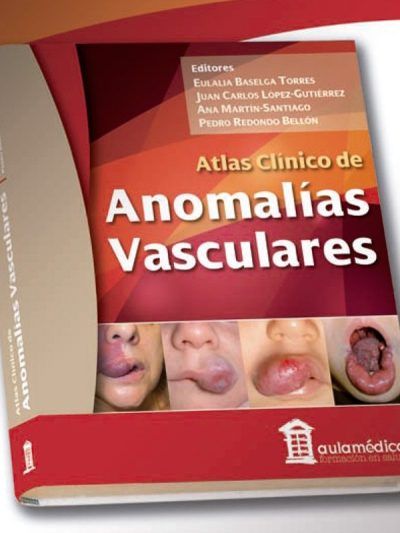 Atlas Clínico de Anomalías Vasculares 1 Edición