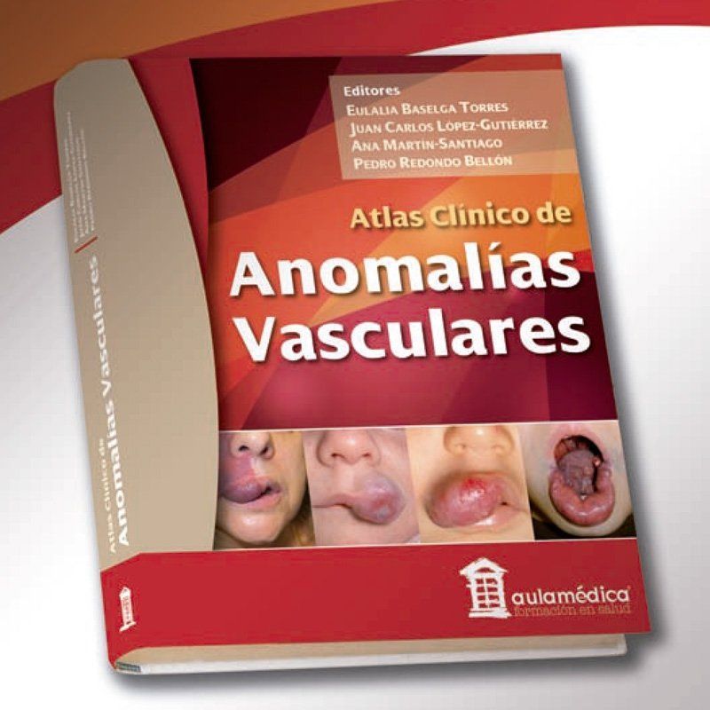 Atlas Clínico de Anomalías Vasculares 1 Edición 1 Atlas Clínico de Anomalías Vasculares 1 Edición