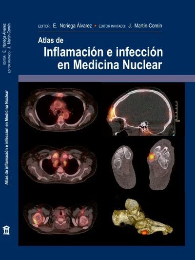 Atlas de Inflamación e Infección de Medicina Nuclear