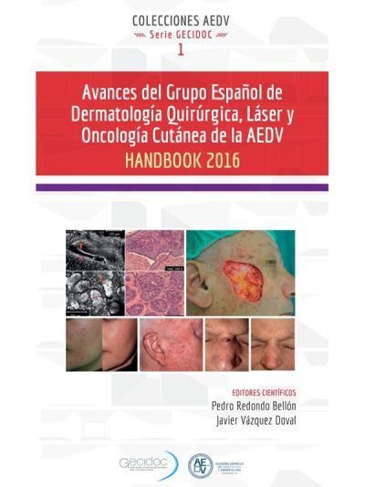 Avances del Grupo Español de Dermatología Quirúrgica Láser y Oncología Cutánea de la AEDV 1 Edición