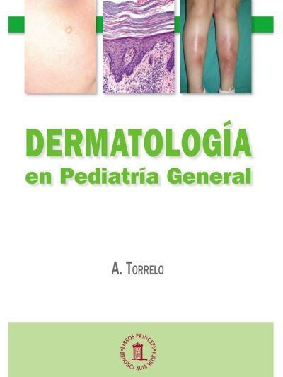 Dermatología en Pediatría General 1 Edición