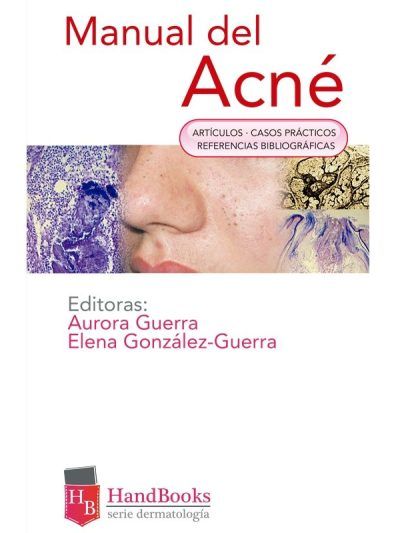 Manual Terapéutica del Acné 1 Edición
