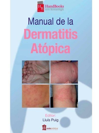 Manual de la Dermatitis Atópica 1 Edición