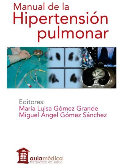 Manual de la Hipertensión Pulmonar 1 Edición