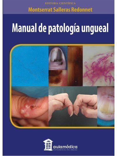 Manual De Patología Ungueal 1 Edición