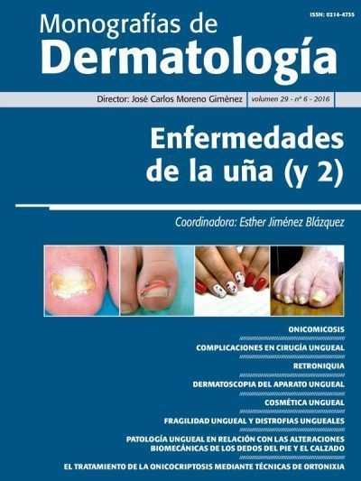 Monografías Dermatología Uñas II