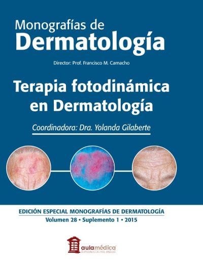 Monografías de Dermatología Terapia Fotodinámica en Dermatología