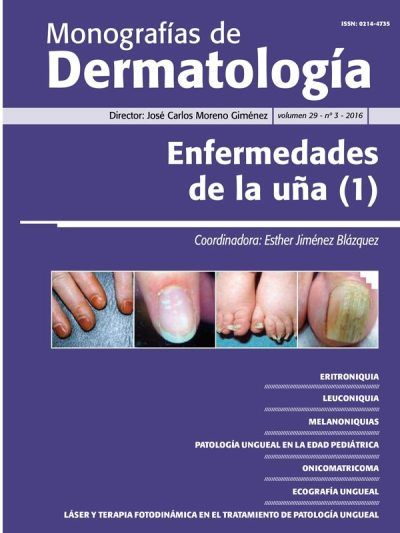 Monografías de Dermatología Uñas