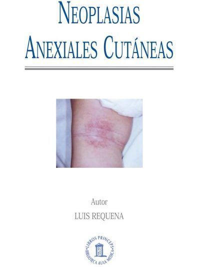 Neoplasias Anexiales Cutáneas 1 Edición