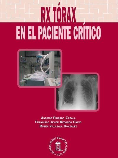 RX Tórax en el paciente crítico 1 Edición