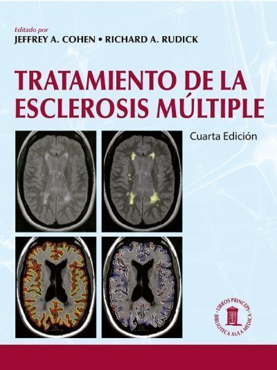 Tratamiento de la Esclerosis Múltiple 4 Edición