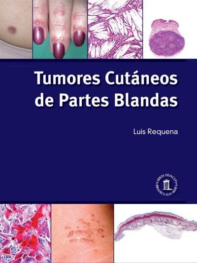 Tumores cutáneos de partes blandas 1 Edición