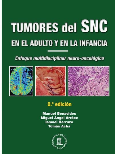Tumores del Sistema Nervioso Central en el Adulto y en la Infancia 2 Edición