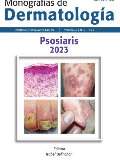 Monografías De Dermatología Psoriasis 2023