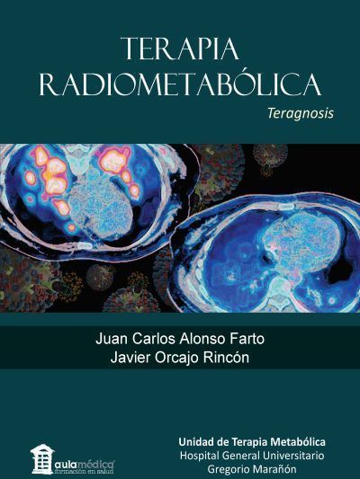 Terapia Radiometabólica Teragnosis